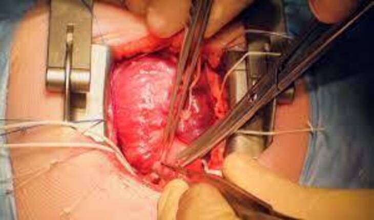 Service Provider of Heart Transplant in New Delhi, Delhi, India.