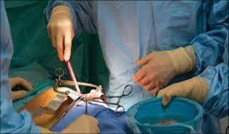 Service Provider of Kidney Transplant in New Delhi, Delhi, India.