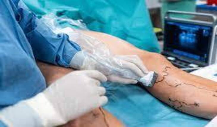 Service Provider of Vascular Surgery in New Delhi, Delhi, India.