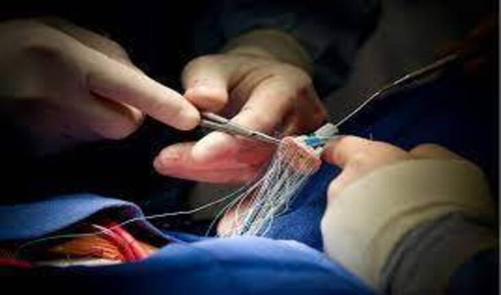 Service Provider of Heart Valve Replacement Surgery in New Delhi, Delhi, India.